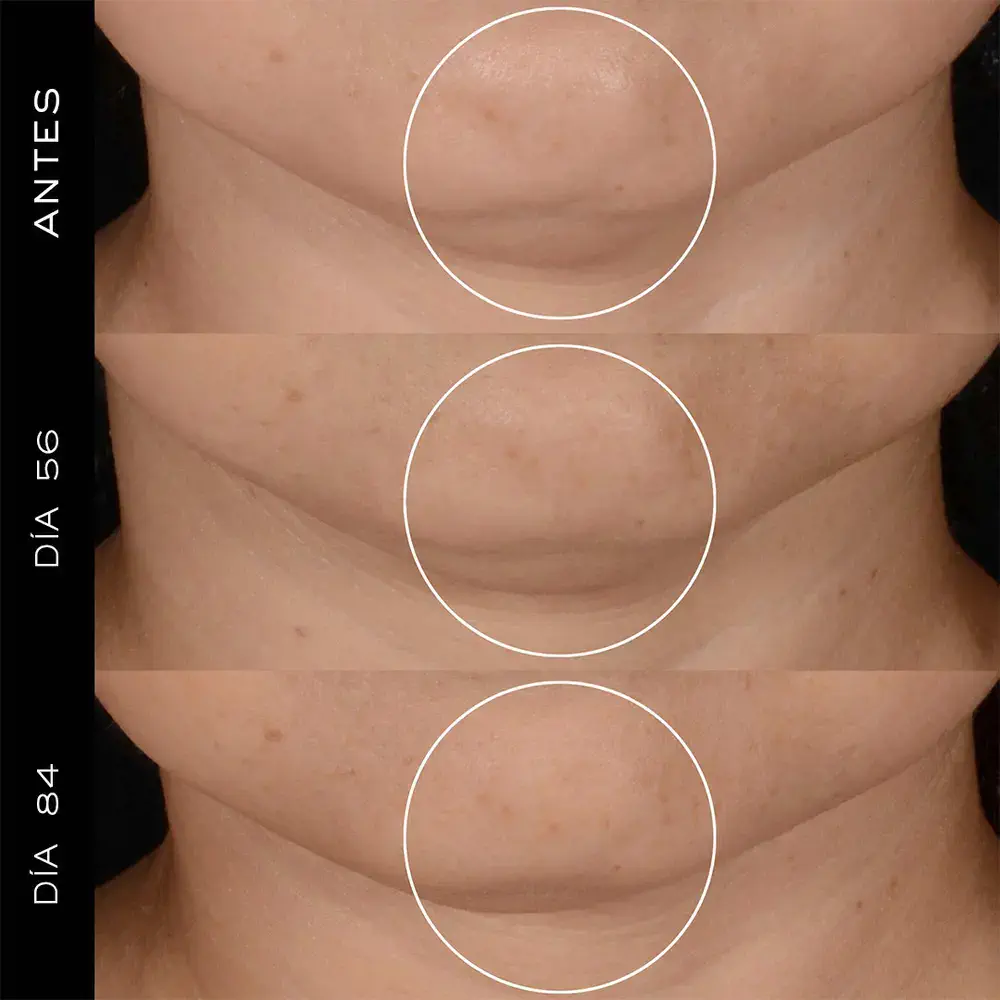 Rénergie - Lancôme Rénérgie Hpn 300-Peptide Cream by Lancôme