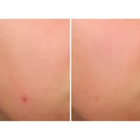 Bye Bye Serums - Bye Bye Brekout Serum by It Cosmetics