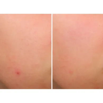 Bye Bye Serums - Bye Bye Brekout Serum by It Cosmetics
