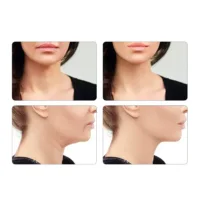 Equipos De Alta Tecnología - Anti-Aging Face And Neck Device Nit by Paloma Beauties